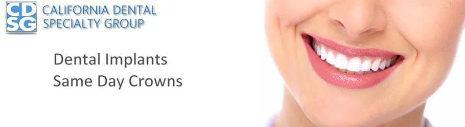 Dental Implants Same Day Crowns