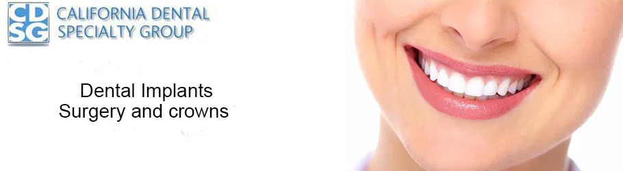 Dental Implants Surgery and crowns Dental Implants Surgery and crowns