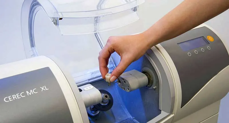 5 Things You Should Know About CEREC Crowns