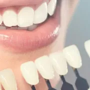 The Importance of Prosthodontists in Restoring Your Smile