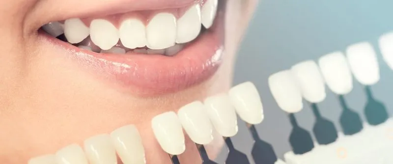 The Importance of Prosthodontists in Restoring Your Smile