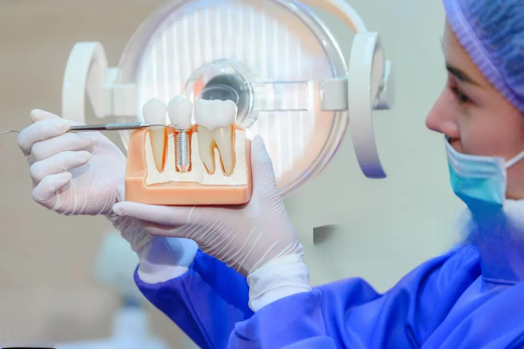 The Dental Implant Process